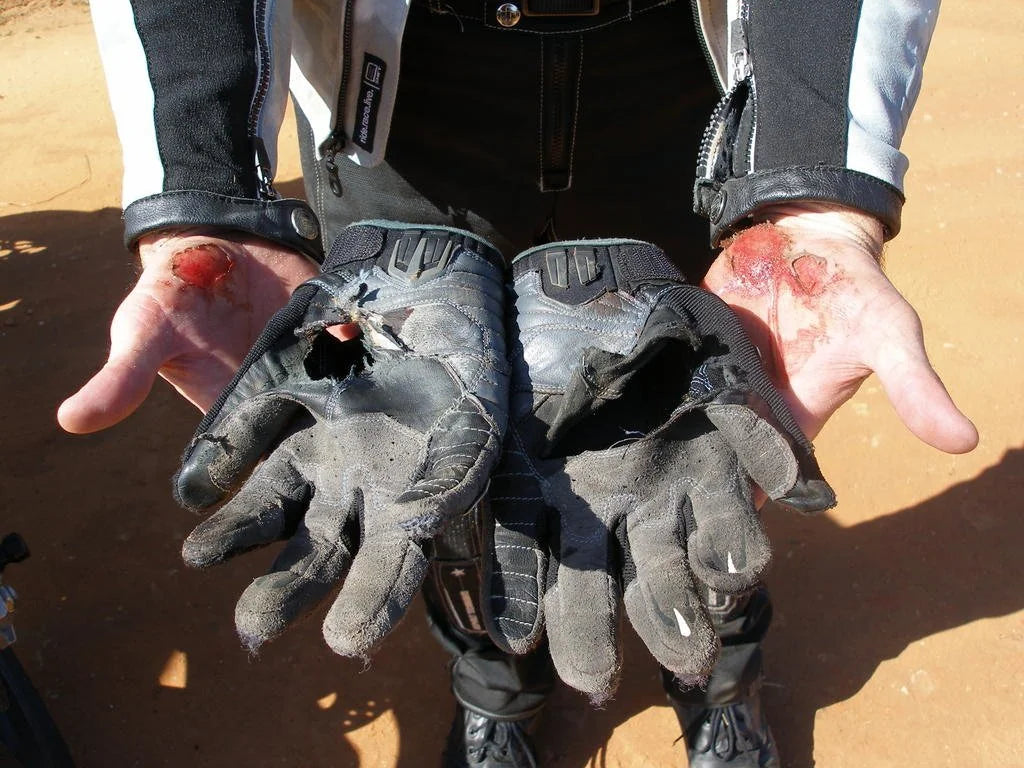 Do Motorcycle Gloves Save Fingers in a Crash?